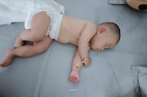 遵化市宝宝头上长痱子